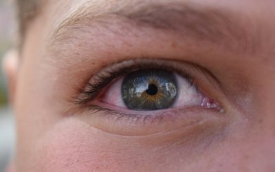 Conjuntivitis, protege la salud de tus ojos